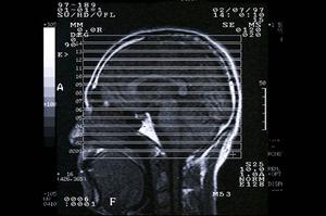 福岡の訪問介護を徹底解説!最新2025年版ガイドで安心サービスを見つけよう